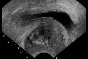 Ecografía Renal. Eco-Doppler Escrotal, Prostático y Vesical (USD)